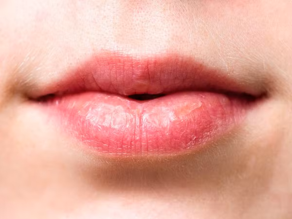 Để có một làn da mịn màng và không bị khô thì bạn cần bổ sung nhiều vitamin C. Ảnh: Boldsky.