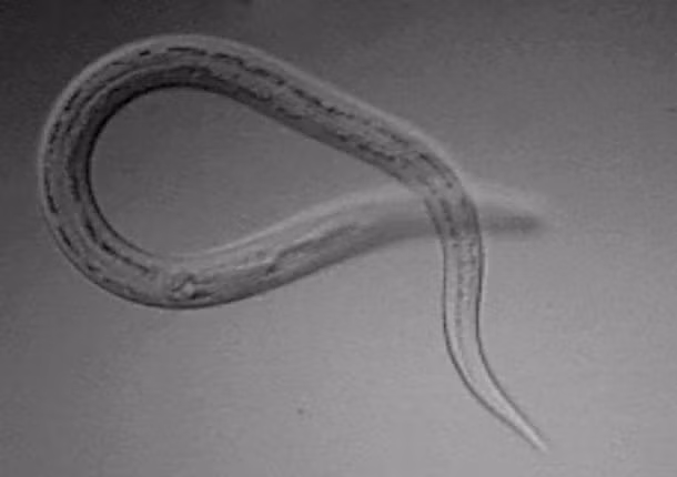 Liệu pháp điều trị bằng giun móc: Nếu bạn có suy nhược các bệnh như bệnh Crohn (bệnh viêm mãn tính của ruột), bệnh đa xơ cứng, hen hoặc bệnh viêm ruột, sử dụng liệu pháp giun sán có thể là một lựa chọn. Ảnh: Healthline.