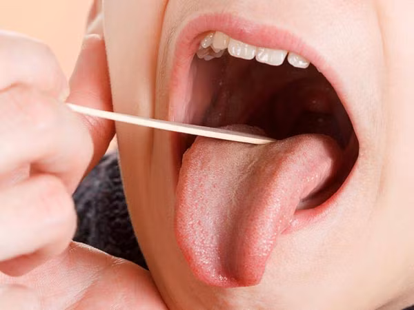 3. Giúp điều trị các vấn đề về đường hô hấp: Nước ép khoai tây giúp ngăn ngừa các bệnh hô hấp khác nhau vì nó làm giảm lượng glucose trong máu. Ảnh: Boldsky.