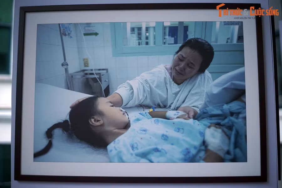  Con đau, mẹ đau: Bé Thương, một bệnh nhân được phẫu thuật theo chương trình từ thiện của quỹ "Thiện nhân và những người bạn" vừa rời phòng mổ. Em rất đau khiến mẹ không cầm được nước mắt.
