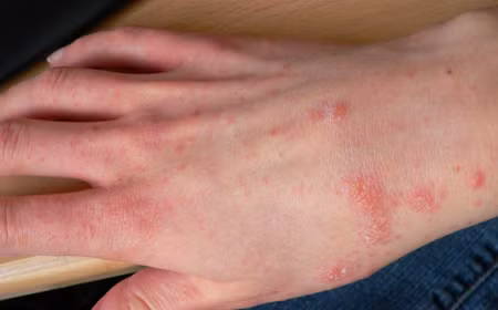Bên cạnh đó, các loại kem chống nắng, mỹ phẩm giả thường chứa nhiều yếu tố kim loại để tạo độ đẹp cho mỹ phẩm, hay các chất tạo mùi… Đây cũng là những chất dễ gây phản ứng phụ.