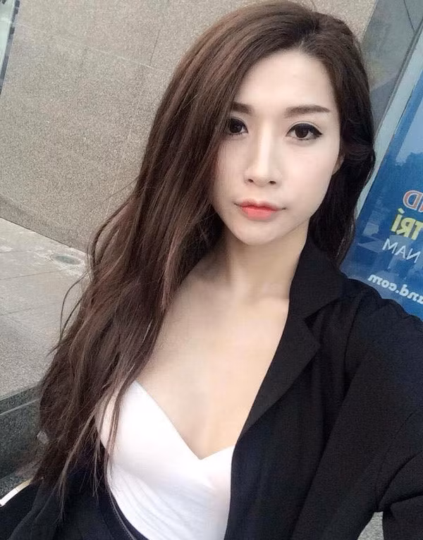 Là hot girl đời đầu nổi tiếng tại Hà Nội, Vân Navy từng nhận được nhiều sự yêu mến và quan tâm bởi vẻ ngoài xinh đẹp, đặc biệt là gương mặt bụ bẫm, đáng yêu. Nhưng càng ngày, gương mặt cô càng thay đổi, làm dấy lên nghi án phẫu thuật thẩm mỹ.
