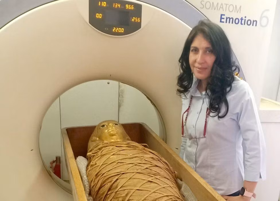 Với kết quả thu được, các chuyên gia phát hiện nhà vua Amenhotep I qua đời khi khoảng 35 tuổi, sở hữu chiều cao 169 cm.