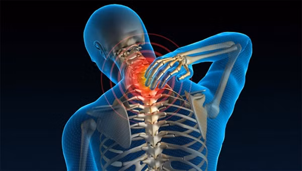 Đa số nguyên nhân đau, mỏi vùng cổ gáy thường do hoạt động cơ quá mức. Nhưng cũng có các nguyên nhân khác như thoái hóa cột sống cổ, thoát vị đĩa đệm vùng cổ chèn ép rễ thần kinh, các bệnh lý miễn dịch như viêm cột sống dính khớp, viêm khớp dạng thấp hoặc các bệnh lý ở khớp vai cũng đau lan lên cổ.