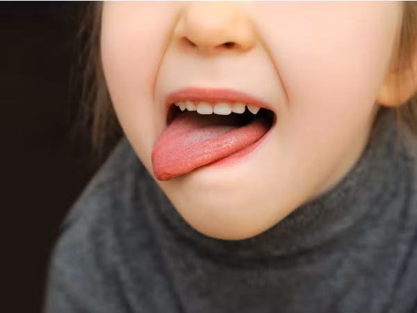 Lưỡi nhăn. Đây là một trong những dấu hiệu ở lưỡi cho thấy sự lão hóa. Những vết nứt ở lưỡi phát triển cho thấy cơ thể bạn đang già đi. Nên chú ý khi vệ sinh răng miệng, tránh nhiễm trùng ở các đường nứt.