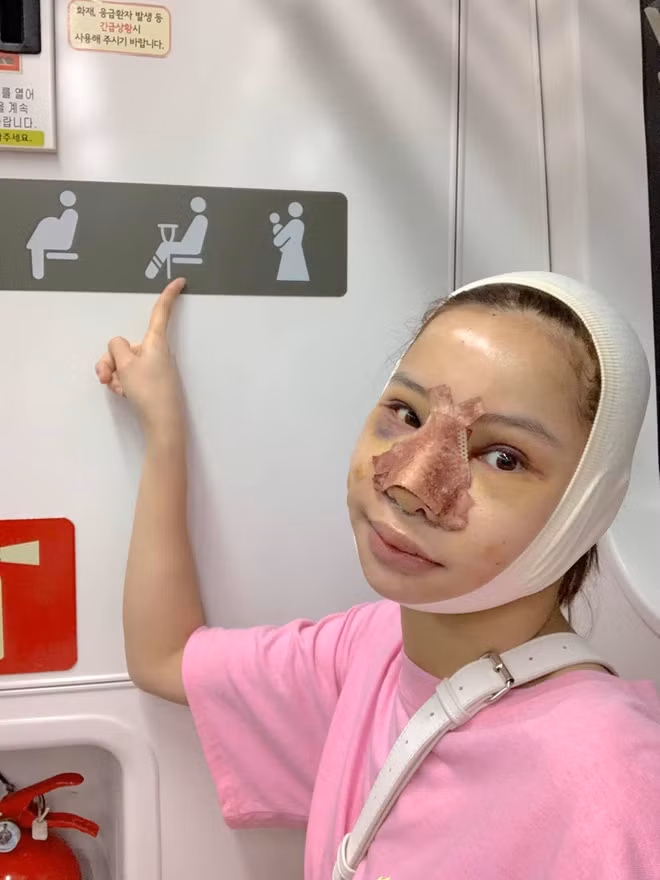 Hình ảnh Lưu Đê Ly với khuôn mặt sưng húp, tím bầm khiến dân tình chỉ còn biết thở dài vì cô nàng quá can đảm.