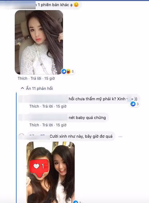 Cư dân mạng dễ dàng nhận thấy sự biến đổi kỳ lạ trên mũi và cằm của Bella, hiện tại tổng thể khiến khuôn mặt của cô nàng trở nên đơ cứng, gượng gạo.