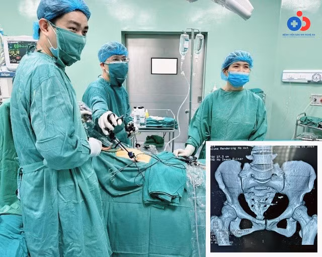 Thủng tử cung, đại tràng…vì vòng tránh thai - Hình 2 Thung tu cung, dai trang…vi vong tranh thai-Hinh-2