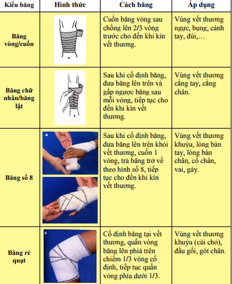 Đừng để mất mạng vì không biết cách sơ cứu cầm máu - Hình 2 Dung de mat mang vi khong biet cach so cuu cam mau-Hinh-2