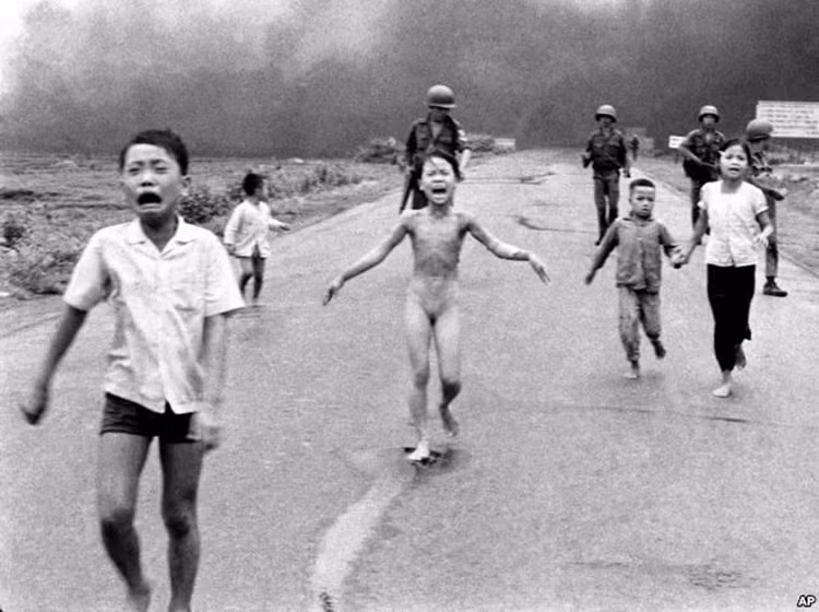 Anh be trai Syria chet duoi chan dong nhu “em be napalm”?-Hinh-2