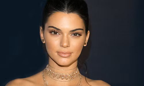Đôi môi của Kendall Jenner càng ngày càng căng mọng và dầy hơn trước nhưng cô một mực phủ nhận chuyện bơm môi. (Ảnh: Internet)