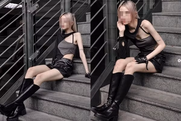 Qua than thiet nguoi ham mo, hot girl gap cai ket ron nguoi