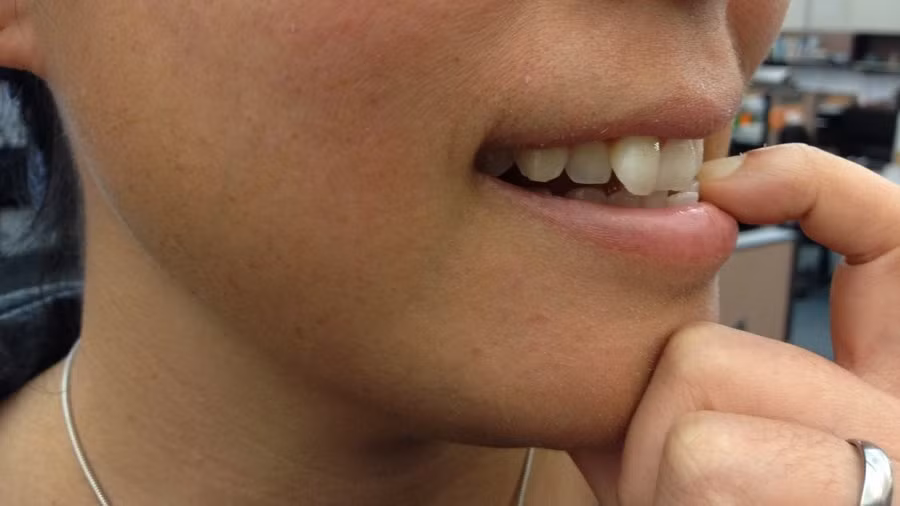 Lý do là vì vi khuẩn từ móng tay sẽ lây truyền và ẩn náu trong khoang miệng, hơi thở do đó sẽ không còn thơm tho nữa. (Nguồn Npr)